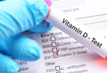 Testung von Vitamin D3 Mangel