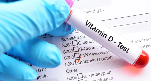 Testung von Vitamin D3 Mangel